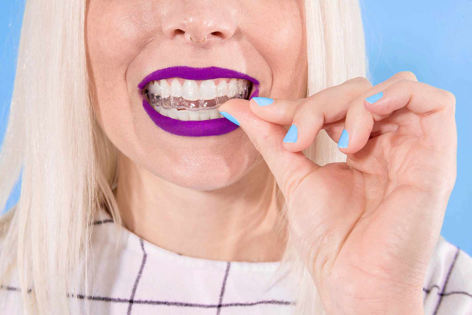 cheap dental aligners